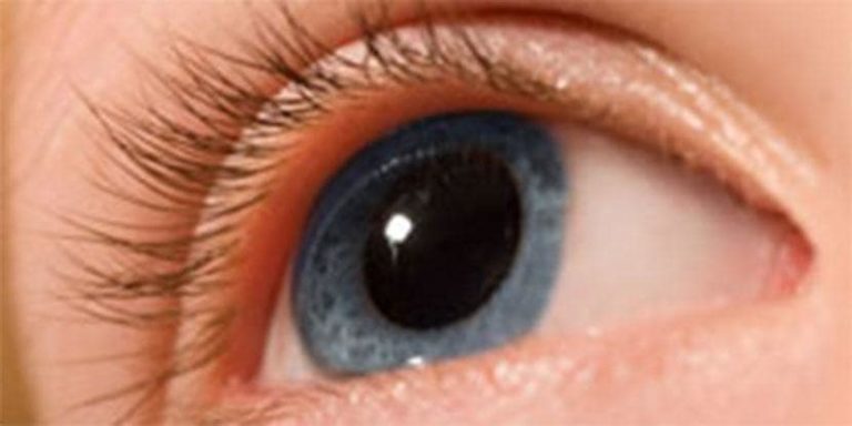 What Are the Warning Signs of Keratoconus and How Can It Be Treated ...